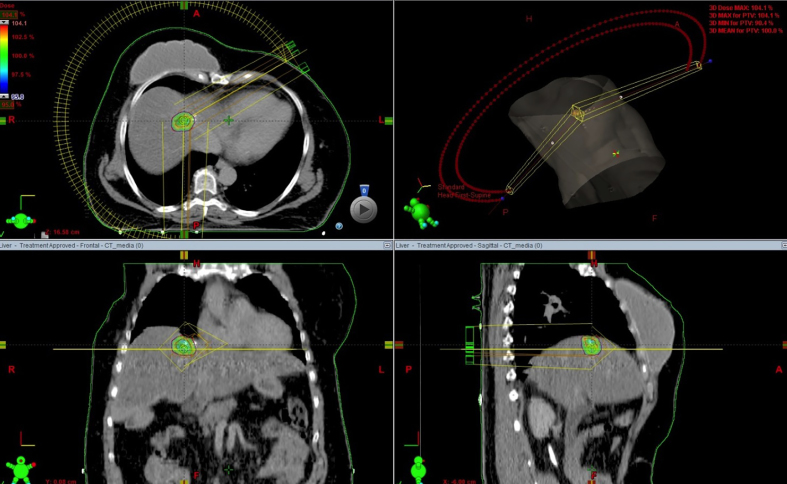 Fig. 2