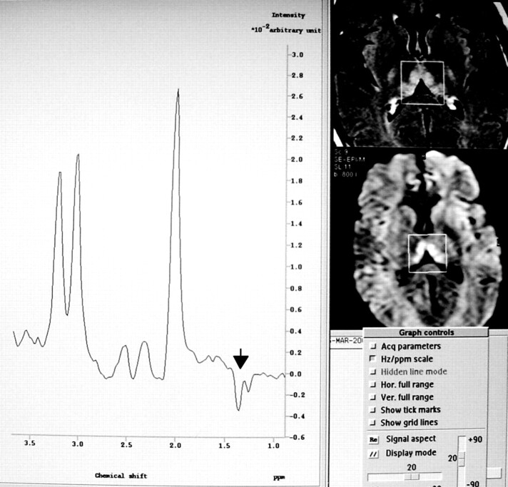 Fig 2.