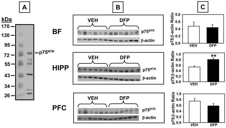 Fig 11