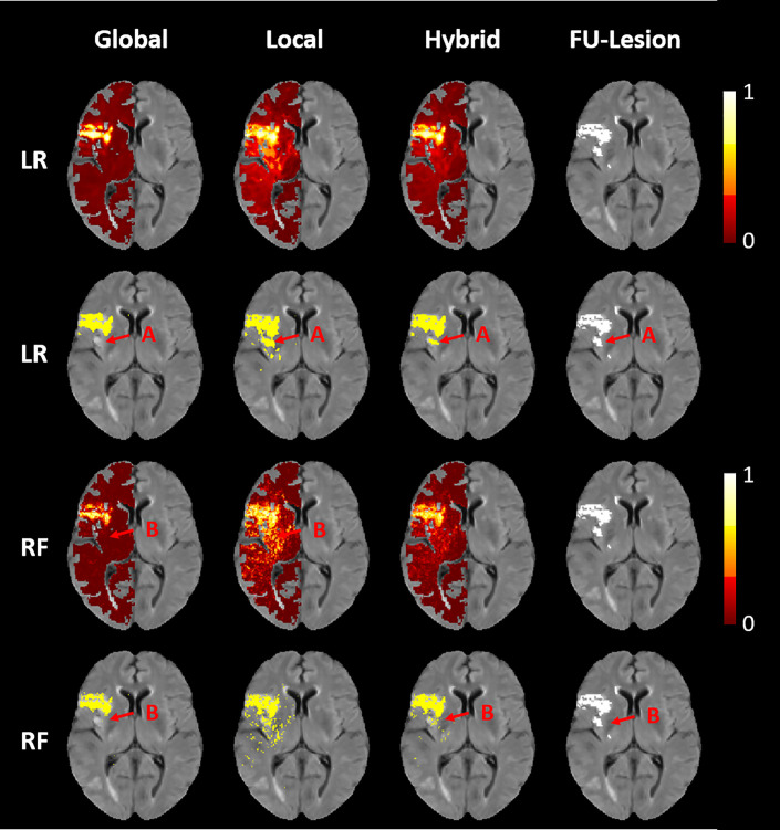 Fig 1