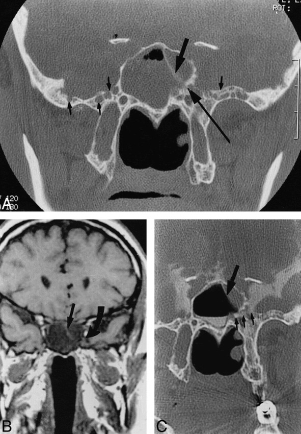 FIG 2.