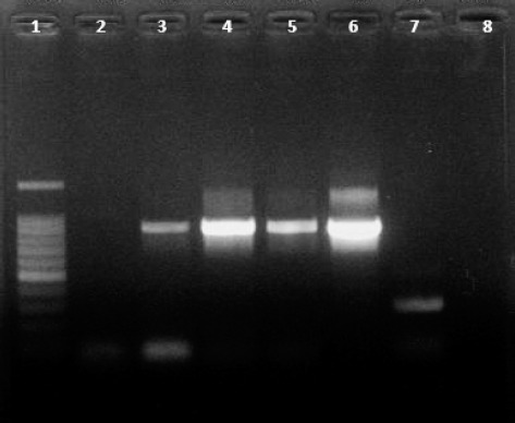 Oral fluid samples from individuals with occult hepatitis B infections. Lane
1: 100 bp molecular weight standard. Lanes 2-5: polymerase chain reaction (PCR)
products of oral fluid samples. Lane 6: serum sample as positive control. Lane
7: serum sample as negative control. Lane 8: PCR Mix control without DNA
template.