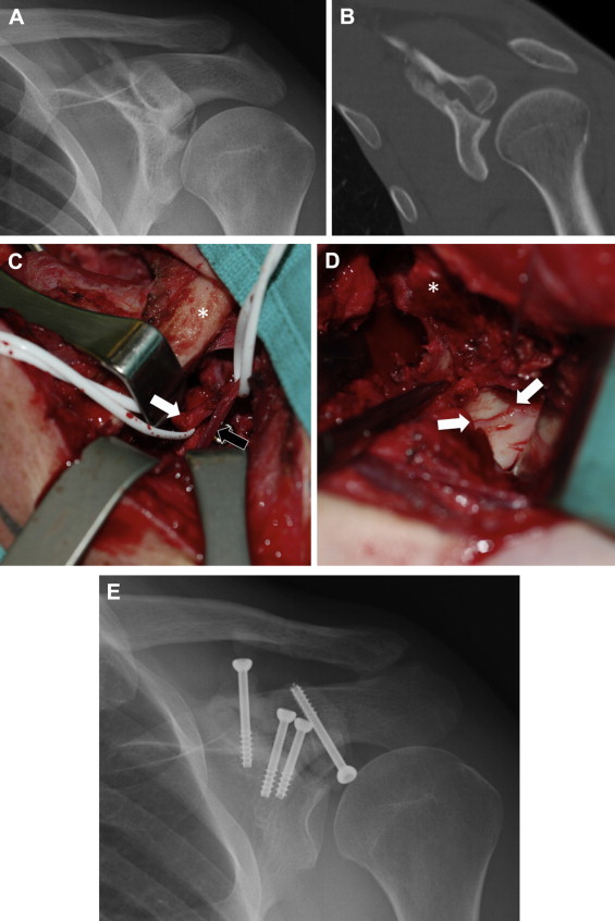 Fig 3