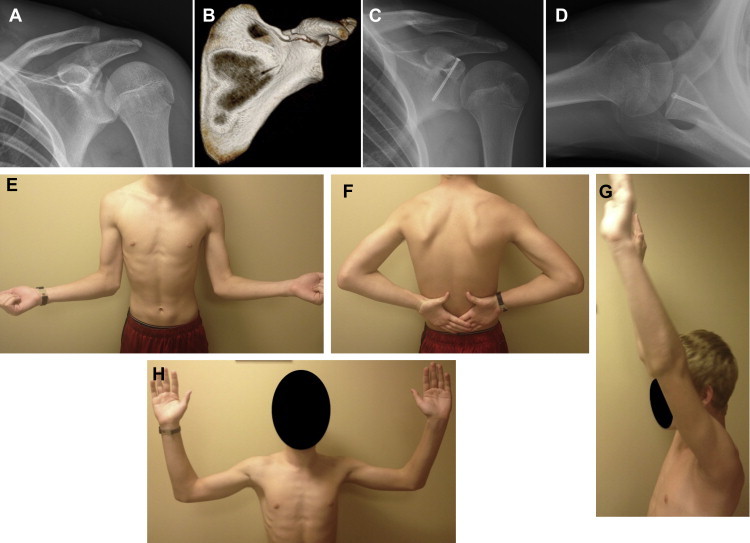 Fig 5