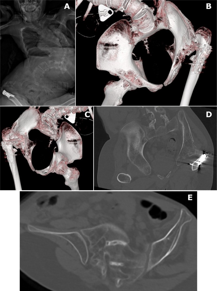 Fig. 2