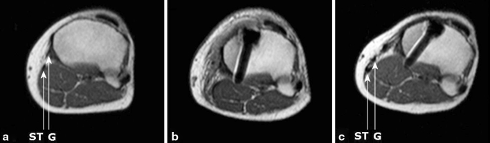 Fig. 5