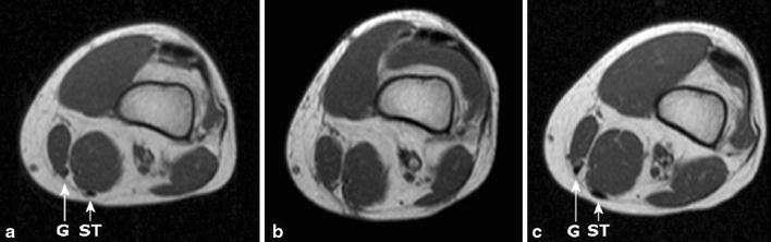 Fig. 4