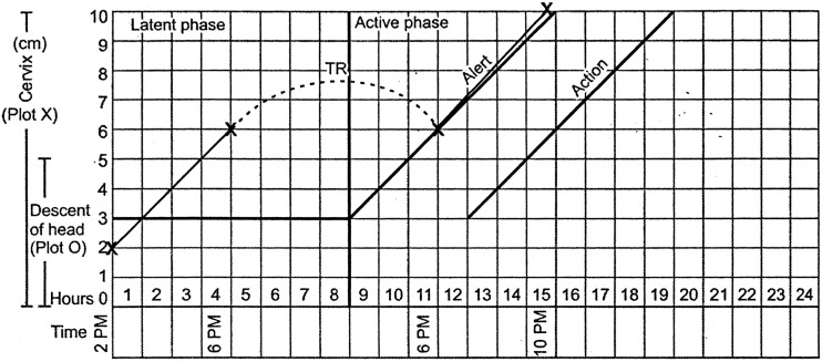 Fig. 5