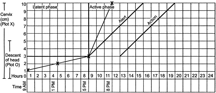 Fig. 4