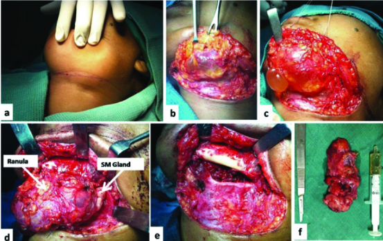 [Table/Fig-4a-f]: