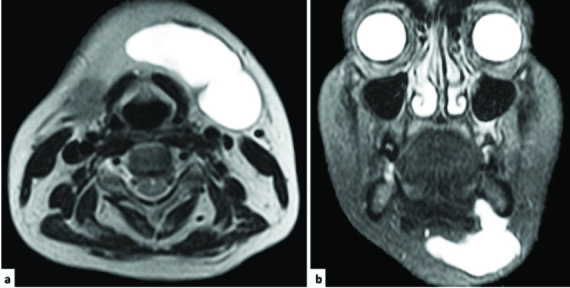 [Table/Fig-3a&b]: