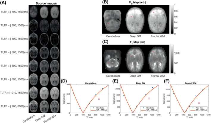 MRM-29509-FIG-0004-c