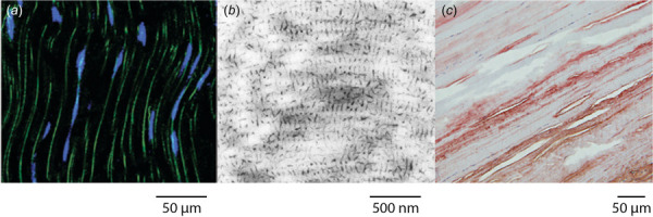 Staining of mature tendon to visualize elastin, the proteoglycan-GAG bridge, and lubricin. (a) Immunostaining of elastin, which exhibits a wavy crimp pattern along the fiber direction (vertical), surrounding tenocyte nuclei (Adapted with permission from Grant et al. [47]. Copyright 2013 by Wiley). (b) Cupromeronic blue staining of proteoglycans, which reveals that the proteoglycan–GAG bridge is oriented orthogonally to horizontal collagen fibrils (Adapted with permission from Liao and Vesely [48]. Copyright 2007 by Elsevier). (c) Immunostaining of lubricin in which intense staining is observed between collagen fascicles (running along the diagonal) and less intense staining is observed within collagen fascicles (Adapted with permission from Sun et al. [49]. Copyright 2015 by Wiley). Images were obtained from bovine flexor tendon, porcine mitral valve chordae tendinae, and human Achilles tendon, respectively.