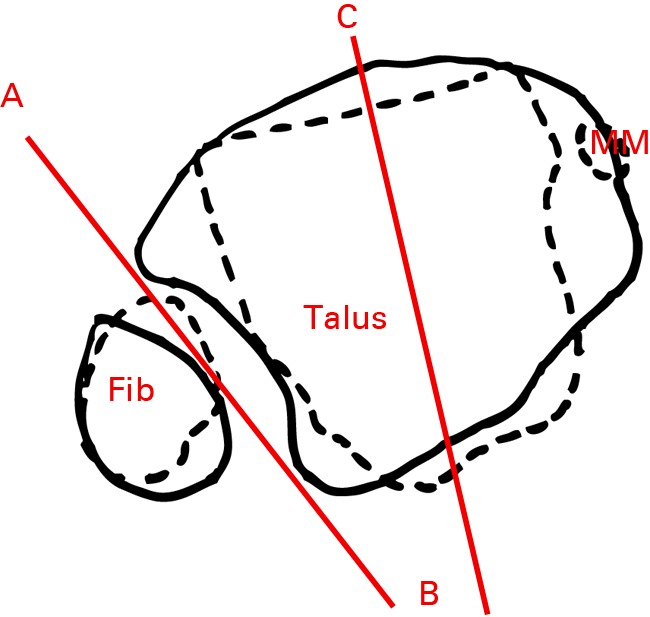 Figs. 4a - 4c