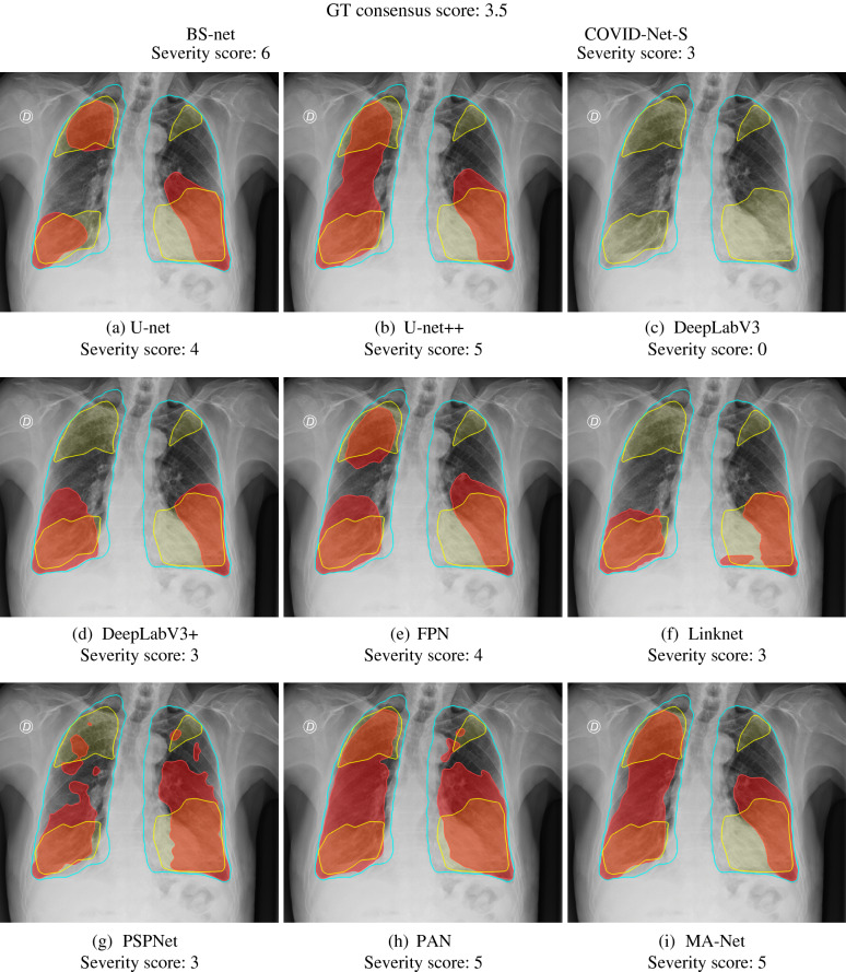 Figure 11