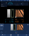 Image shows the controlled attenuation parameter (CAP), which is a
nonimaging sonographic method to estimate steatosis available on a
vibration-controlled transient elastography point-of-care device (FibroScan;
Echosens).
