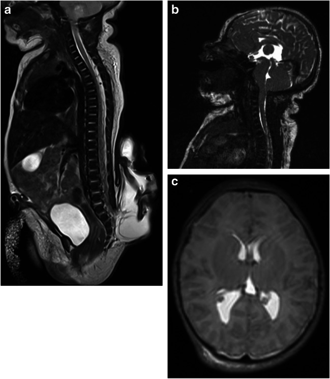 Fig. 1