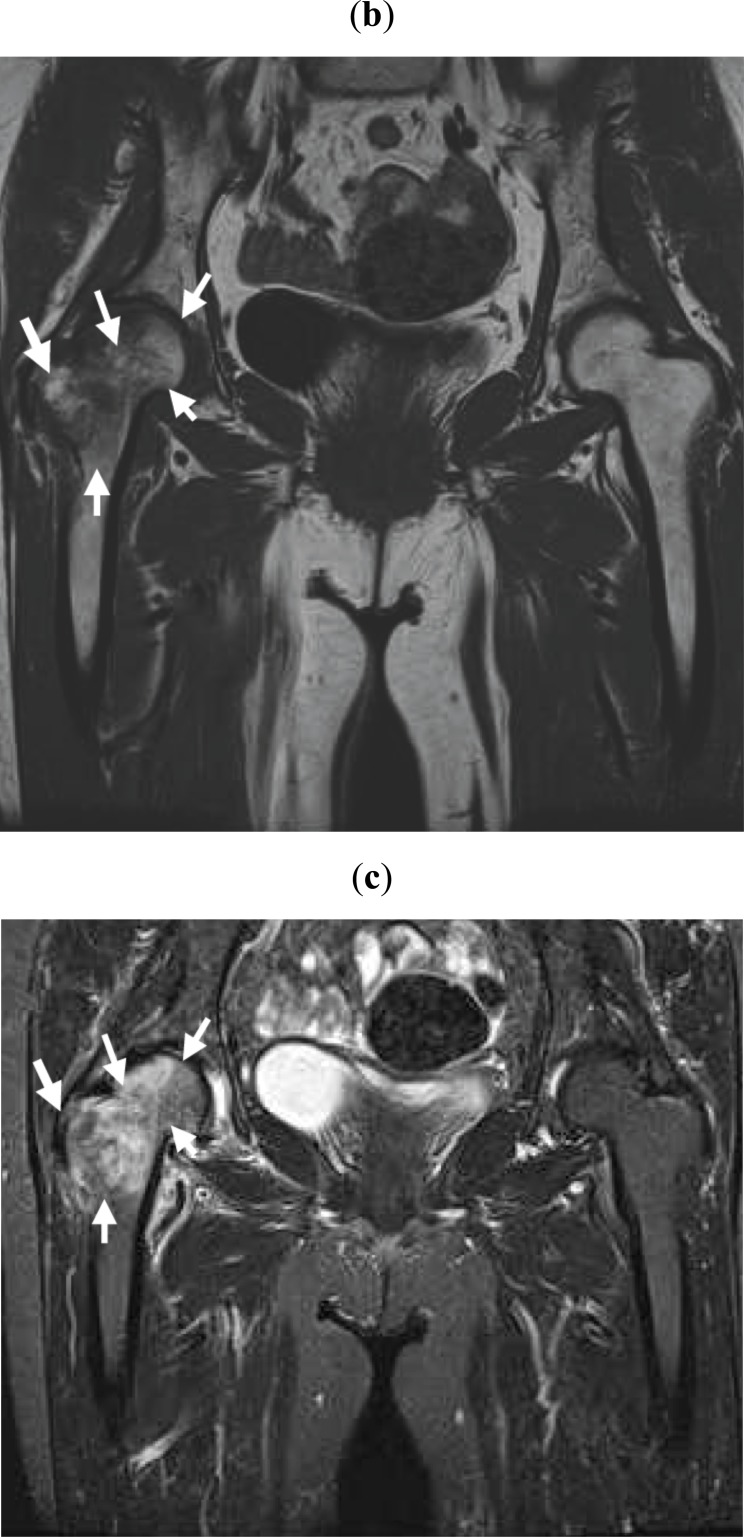 Fig. (1b,c)