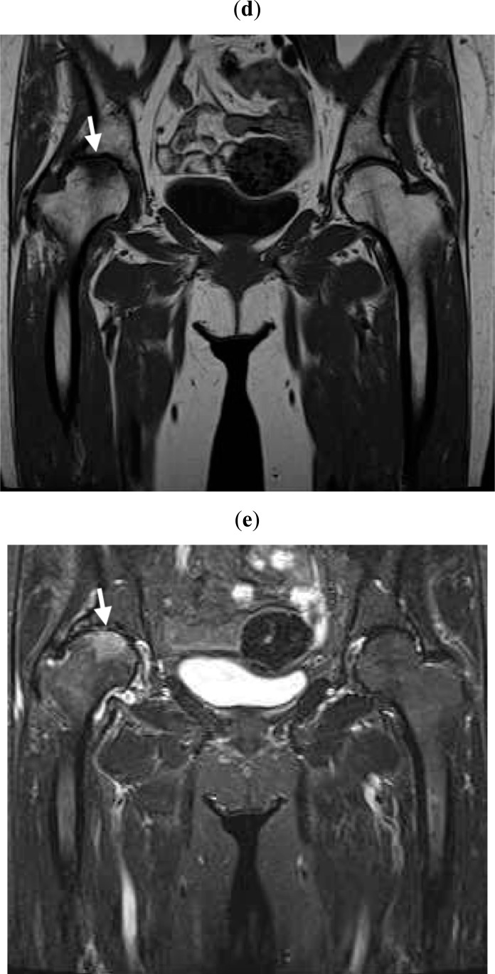 Fig. (1d,e)