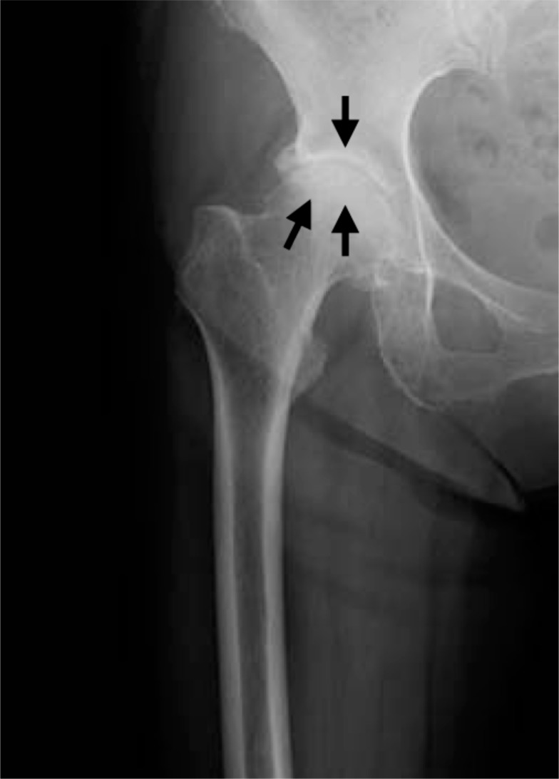 Fig. (1f)