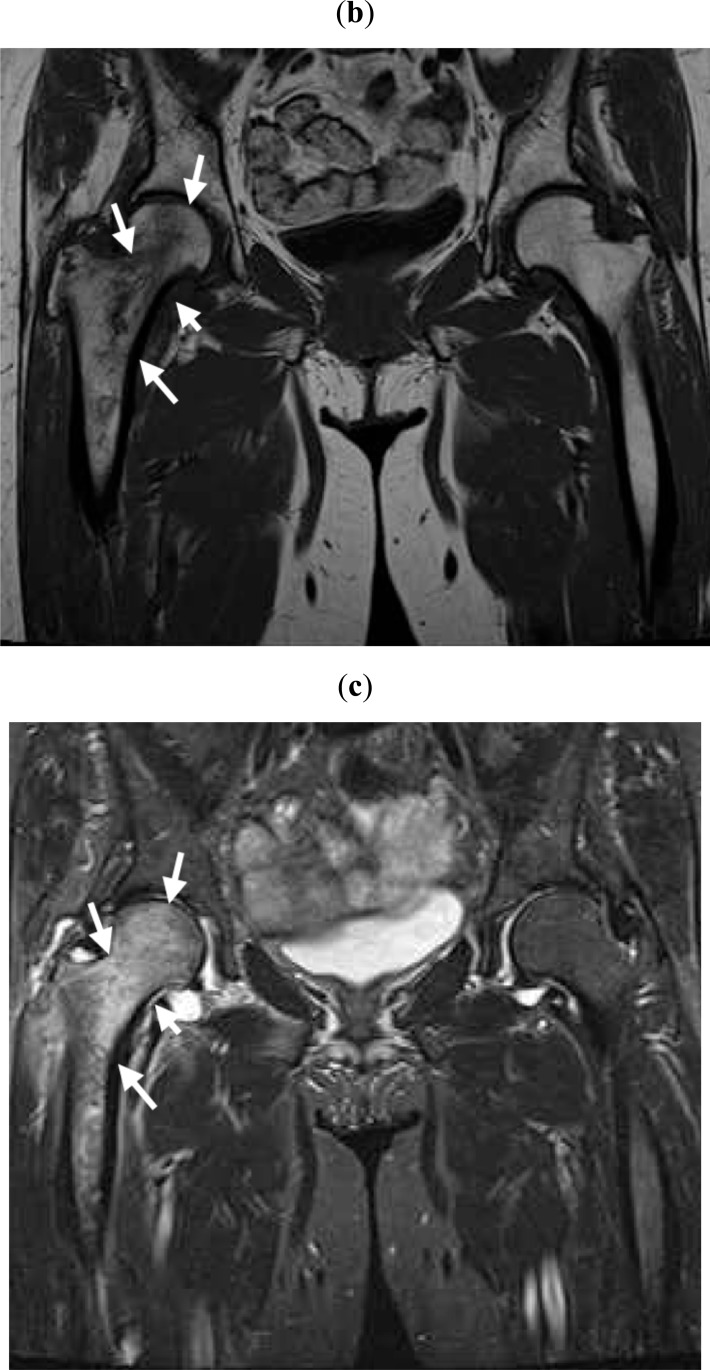 Fig. (2b,c)