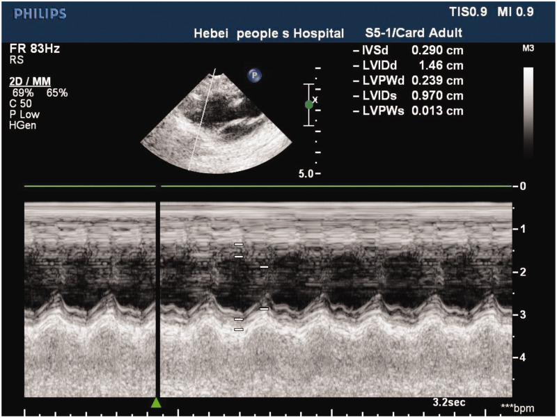 Figure 2.