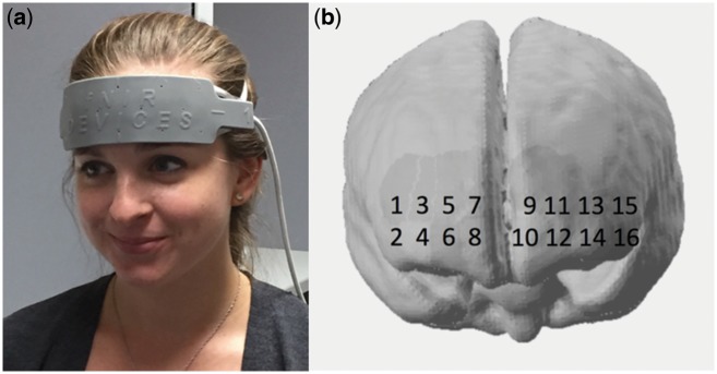 Fig. 1.