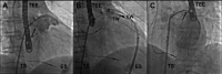 Figure1