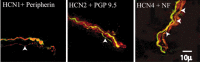 Figure 11.