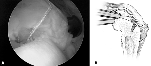 Fig. 5A–B