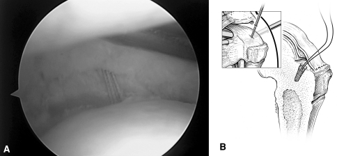 Fig. 3A–B