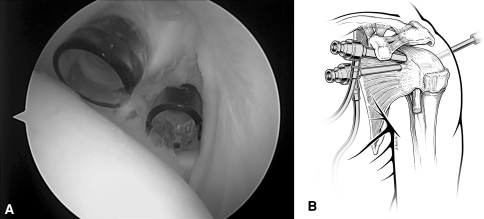 Fig. 2A–B