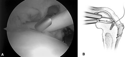 Fig. 4A–B