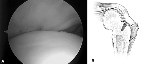 Fig. 6A–B