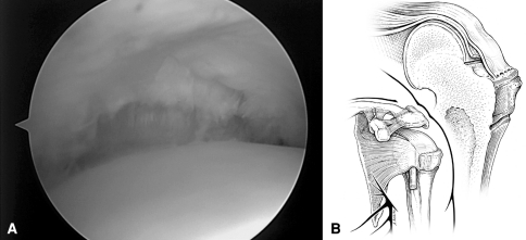 Fig. 1A–B