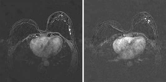 Fig. 11