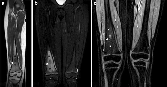 Fig. 12