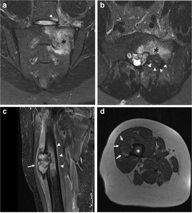 Fig. 13