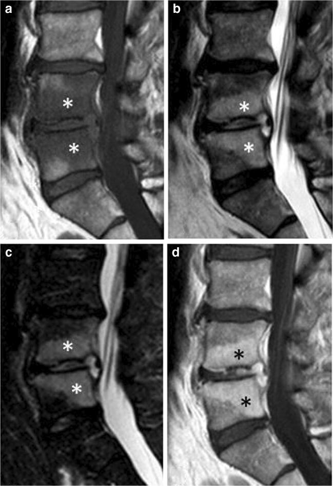 Fig. 11