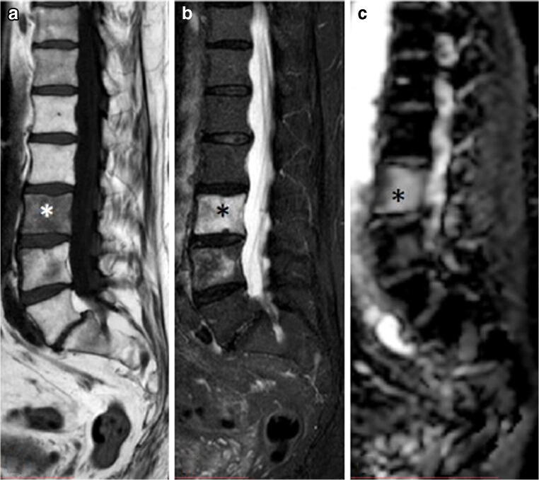 Fig. 14