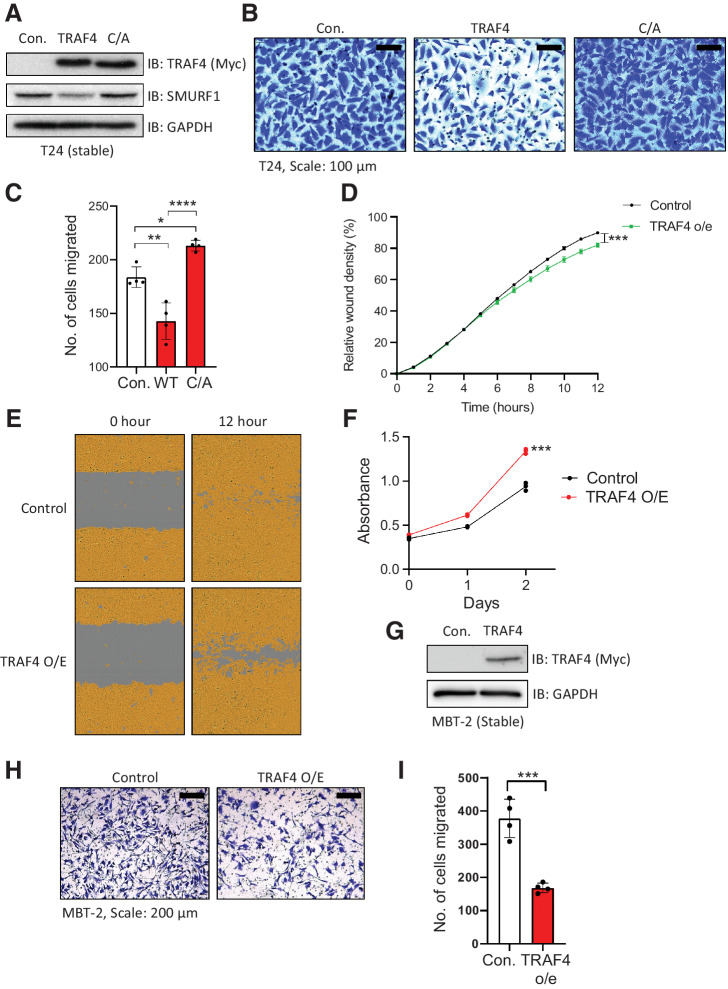 Figure 4. Ectopic expression of TRAF4 in mesenchymal cells inhibits their migration and invasion. A, Immunoblot showing T24 cells stably expressing either control vector (Myc-tag), TRAF4 or the catalytically inactive TRAF4 mutant (C/A: cysteine substituted with alanine at residue C18). GAPDH, loading control. B, Representative images of Transwell assays performed on T24 cells stably expressing TRAF4 or the catalytically inactive TRAF4 mutant (C/A) are shown. Cells were stained with crystal violet; scale bar: 100 μm. C, Quantification of the number of migrated cells in four random fields. The error bars indicate ± SD; **, P ≤ 0.01 and ****, P ≤ 0.0001 calculated using one-way ANOVA, 4 technical repeats. D, Graph showing the relative wound widths as determined with an IncuCyte system. Representative results from ten independent experiments are shown; the error bars indicate ± SEM; ***, P ≤ 0.001 calculated using two-tailed Student t test (n = 10). E, Representative images related to the graph shown in D; the brown area represents the cell coverage, and the gray area indicates the initial wound produced and the remaining wound after 12 hours. F, MTS cell viability/proliferation assay performed with either control T24 cells or T24 cells stably expressing TRAF4. The absorbance was measured at the indicated time points; the error bars indicate ± SD from three sample replicates; ***, P ≤ 0.001 calculated using two-tailed Student t test (n = 3). G, Immunoblot results for MBT-2 cells stably expressing either control vector (empty vector with a Myc-tag) or Myc-TRAF4. GAPDH, loading control. H, Representative images of Transwell assays performed on control and TRAF4-overexpressing MBT-2 cells stained with crystal violet; scale bar: 200 μm. I, Quantification of the number of migrated cells in four random fields. The error bars indicate ± SD; ***, P ≤ 0.001 calculated using two-tailed Student t test, 4 technical repeats.