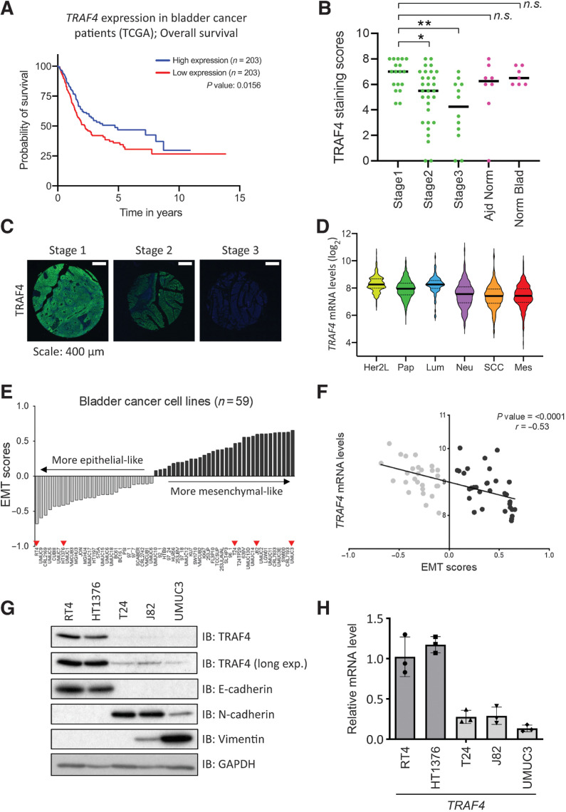 Figure 1. TRAF4 is downregulated in aggressive bladder tumors and mesenchymal bladder cancer cell lines. A, Kaplan–Meier plot showing the overall survival of patients with bladder cancer stratified by TRAF4 expression. Data were obtained and reproduced from TCGA (ref. 24; obtained from Human Protein Atlas; ref. 25), and the median Fragments Per Kilobase of transcript per Million mapped reads (FKPM) value was taken as the TRAF4 expression cutoff, n = 203. B, Graph showing TRAF4 expression through scores obtained from IHC analysis of a tissue microarray; *, P ≤ 0.05 and **, P ≤ 0.01 calculated using one-way ANOVA; n.s. indicates a nonsignificant P value. C, Representative IHC images of TRAF4 expression (green) in the tissue microarray from stage 1–3 bladder tumors are shown. Scale bar, 400 μm. D, Violin plot showing the TRAF4 expression level (and distribution) in different subtypes of bladder cancer; Her2L: Her2-like (n = 253), Pap: papillary (n = 674), Lum: luminal (n = 107), Neu: neural (n = 448), SCC (n = 333) and Mes: mesenchymal (n = 308). The black bars in the middle of the distribution indicate the medians. The subtypes are arranged according to their EMT scores (26, 27). E, Plot showing the EMT scores in 59 bladder cancer cell lines; the light grey bars indicate cell lines with a negative EMT score, the dark grey bars indicate cell lines with a positive EMT score, and the red arrowheads indicate the cell lines that were used for further investigation (28). F, Regression plot of TRAF4 expression levels vs. EMT scores in 59 bladder cancer cell lines. G, Immunoblot analysis showing the expression of TRAF4 and other EMT marker proteins. GAPDH, loading control. Representative results of 2 independent biological replicates. H, Real-time PCR data showing TRAF4 mRNA expression in cell lines. The error bars indicate ± SD. Epithelial cell lines (light grey bars) had significantly higher TRAF4 expression than mesenchymal cell lines (dark grey bars). Performed in 3 technical repeats.