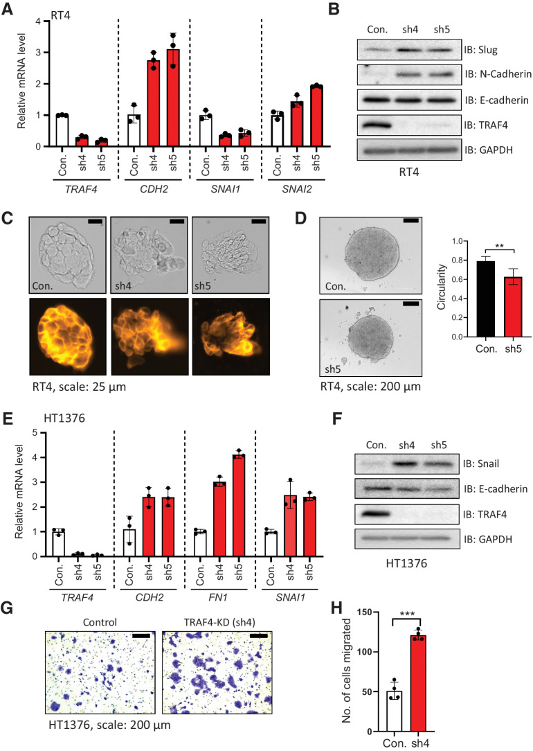 Figure 3. Knockdown of TRAF4 in epithelial (bladder cancer) cell lines leads to loss of epithelial integrity and changes in EMT marker expression. A, Real-time PCR results from RT4 cells showing the mRNA expression levels of the indicated genes; the error bars indicate ± SD, performed in 3 technical repeats. B, Immunoblot results showing changes in EMT marker protein expression in RT4 cells upon TRAF4 knockdown. GAPDH, loading control. Representative result of 2 biological replicates. C, RT4 cell colonies visualized by brightfield imaging (top) or after staining with CellMask Orange Plasma membrane stain (bottom); scale bar: 25 μm. Representative of n = 5. D, Images showing RT4 spheroids formed from control (empty pLKO vector) and TRAF4 knockdown (sh5) cells; scale bar: 200 μm. The graph shows circularities calculated from five independent spheroids of different sizes (n = 5). The error bars indicate ± SD; **, P ≤ 0.01 calculated using two-tailed Student t test. E, Real-time PCR results from HT1376 cells showing the mRNA expression levels of the indicated genes; the error bars indicate ± SD performed in 3 technical repeats. F, Immunoblot results showing EMT marker protein expression levels in HT1376 cells with or without TRAF4 knockdown. GAPDH, loading control. Representative results of 2 biological repeats. G, Representative images of Transwell assays performed on HT1376 cells are shown. Cells were stained with crystal violet; scale bar: 200 μm. H, Quantification of the number of migrated cells in four random fields; the error bars indicate ± SD; ***, P ≤ 0.001 calculated using two-tailed Student t test, 4 technical repeats.