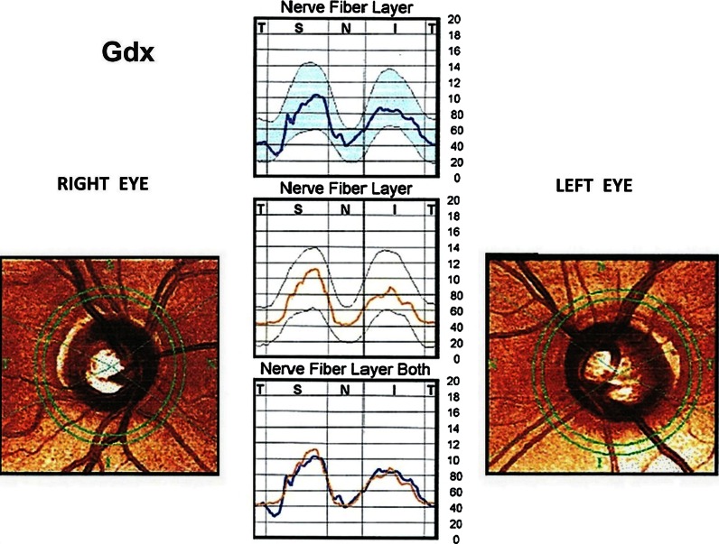 Fig. 2