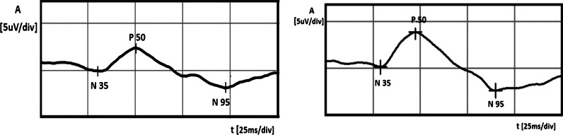 Fig. 4