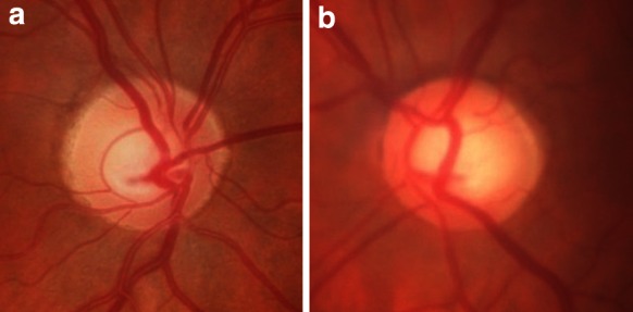 Fig. 1