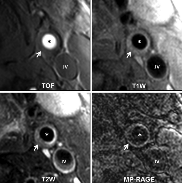 Figure 3