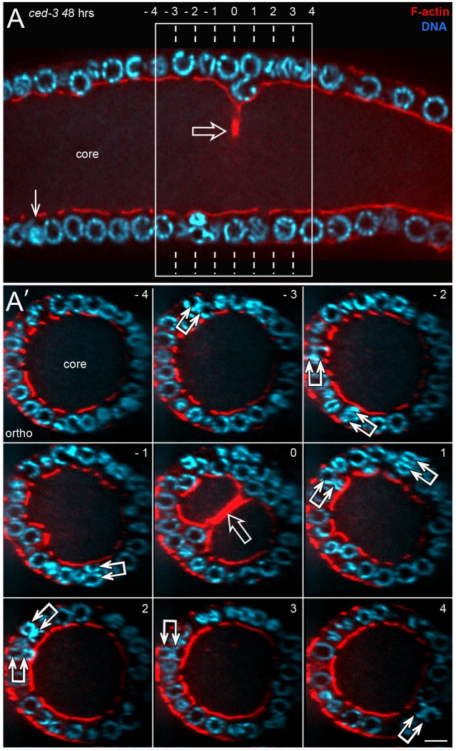 Fig 14