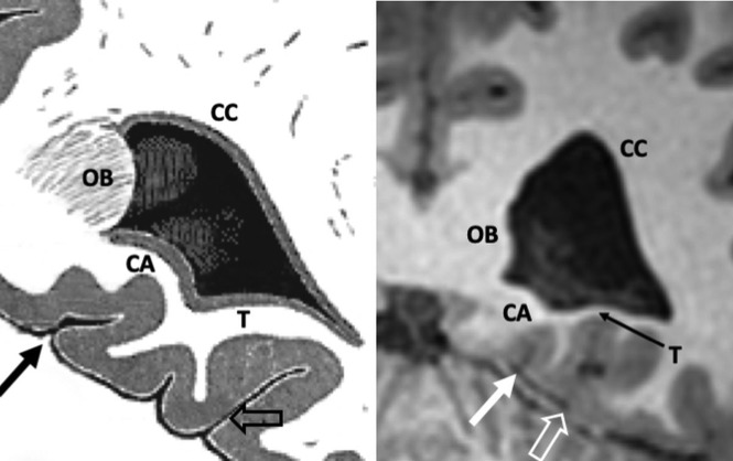 Fig 2.