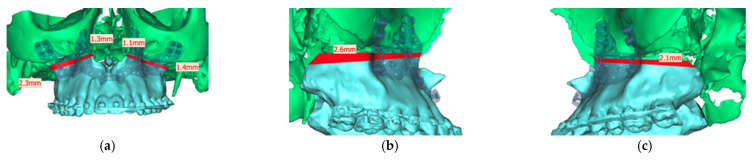 Figure 13
